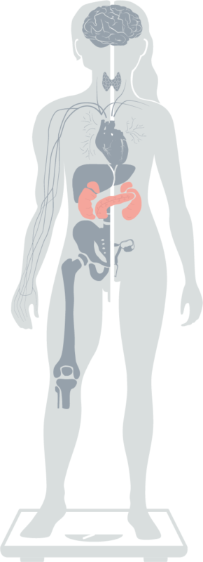 Grafik der Spezialisierungen abgebildet auf einer Figur – Hervorgehobene Spezialisierung Diabetes Grafik der Spezialisierungen abgebildet auf einer Figur - Hervorgehobene Spezialisierung Diabetes