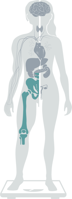 Grafik der Spezialisierungen abgebildet auf einer Figur - Hervorgehobene Spezialisierung Knochendichte